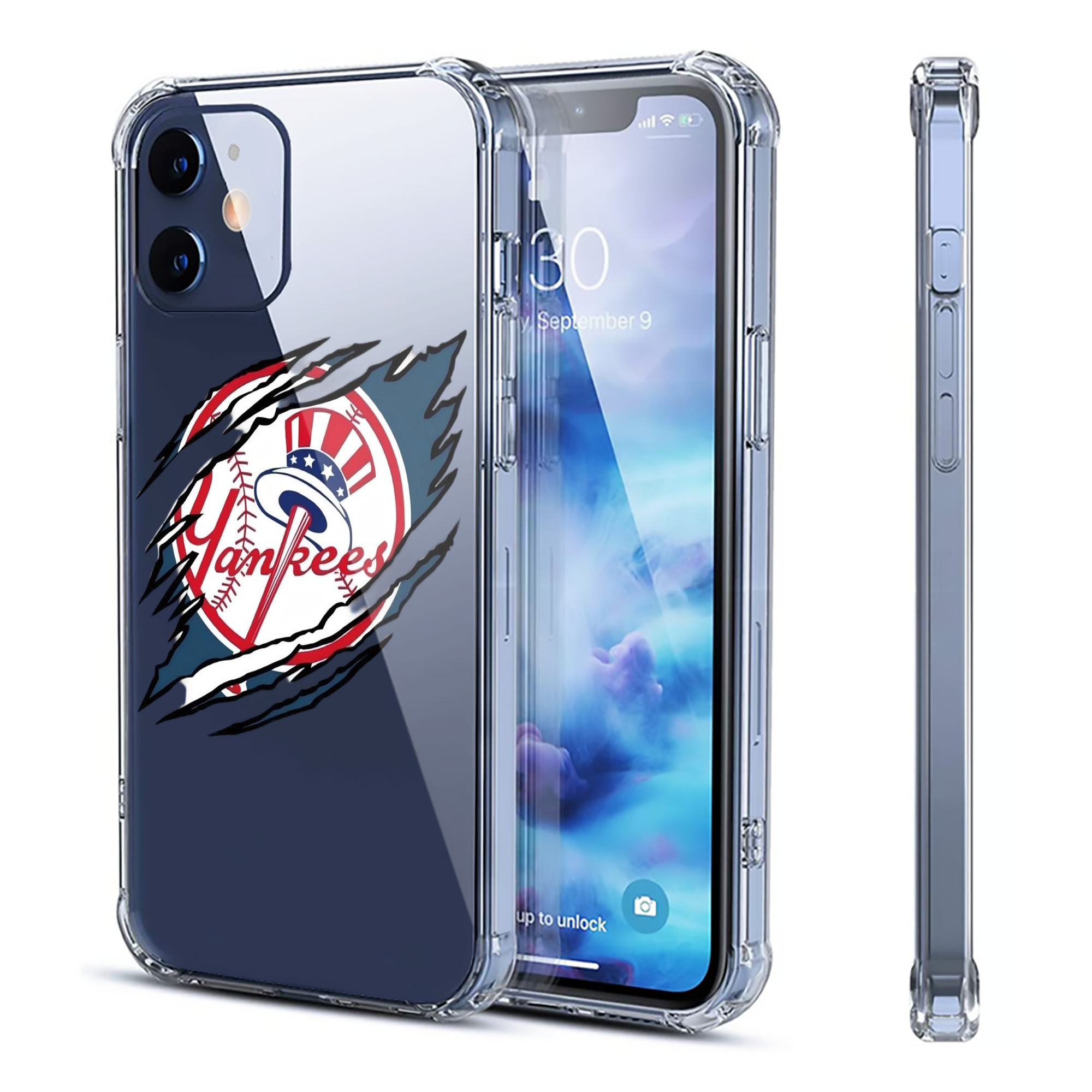 New York Yankees Claw Logo Clear IPhone 12 Case – Soft TPU With UV Print – Enhanced Drop Protection, Precise Fit, Anti-Fingerprint, Customizable Design, Scratch-Resistant, Yellow-Resistant